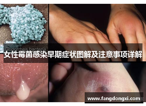 女性霉菌感染早期症状图解及注意事项详解